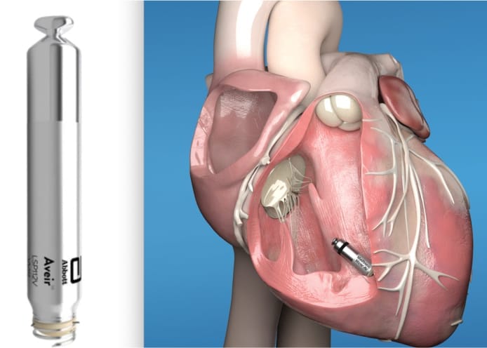 Heart News - The Pediatric Pacemaker Project